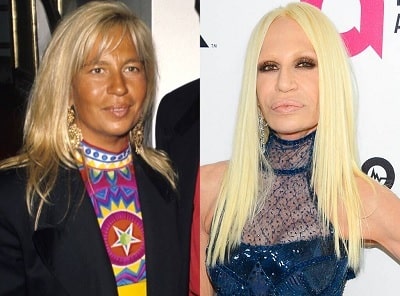 A picture of Donatella Versace before (left) and after (right).